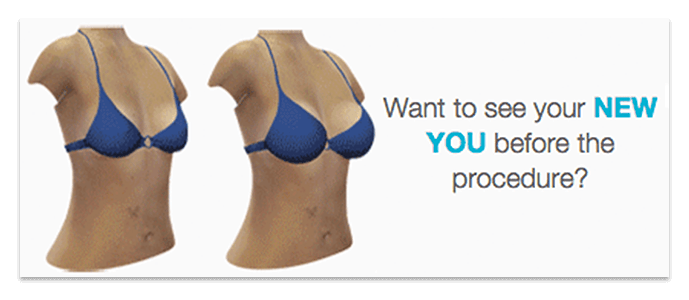 Want to see your new you before the procedure?