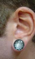 Ear lobe repair San Diego