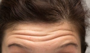 Woman With Wrinkles on Forehead